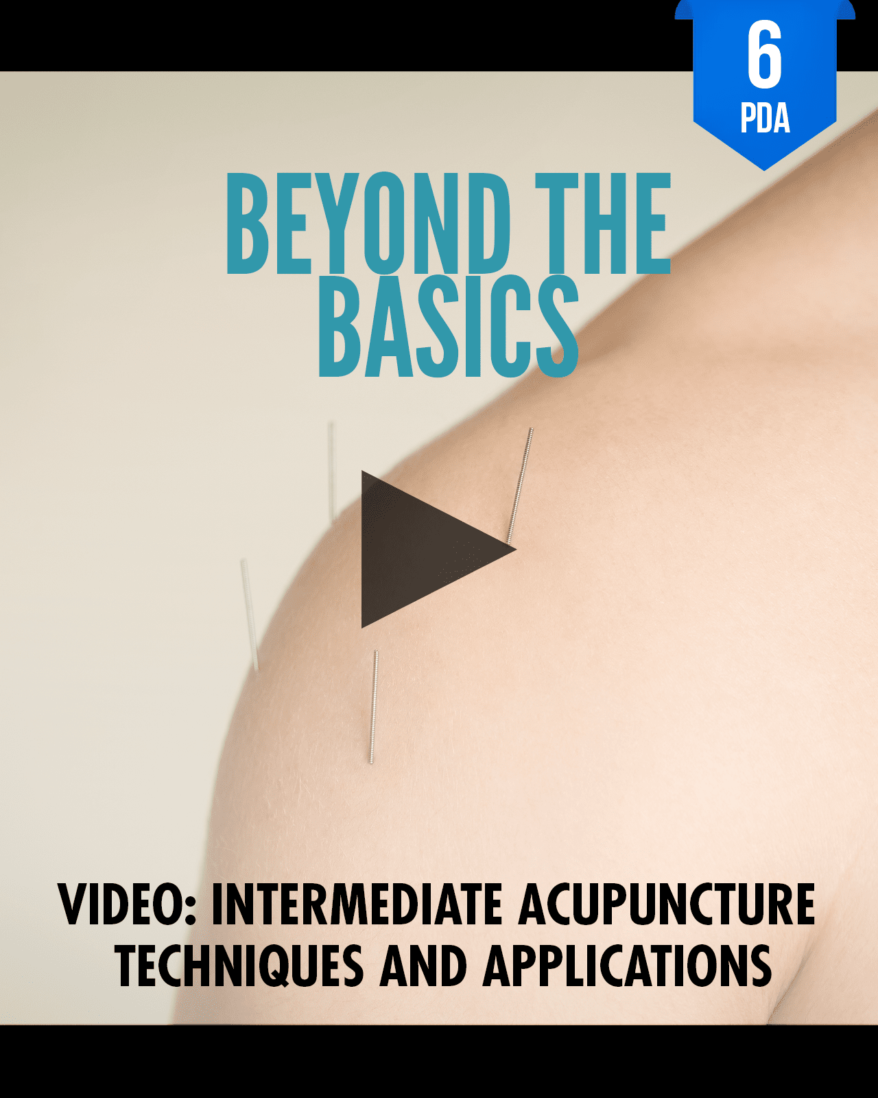 Beyond the Basics: Intermediate Acupuncture Techniques and Applications - NCCAOM Approved Acupuncture Continuing Education, AOM General Hours, 6 PDA/CEU ACEU Masters continuing education florida california nccaom australia uk canada