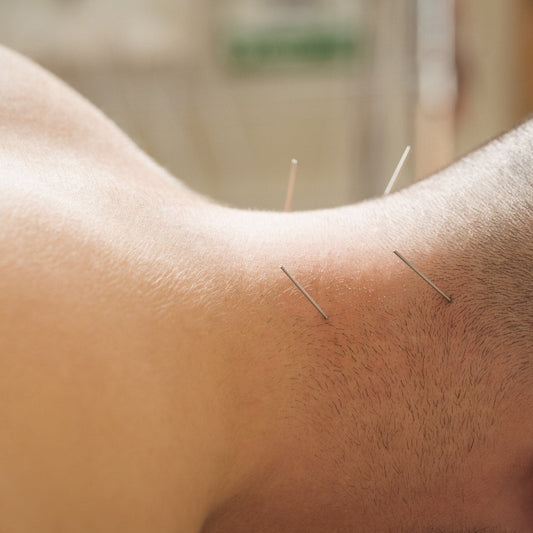 Debunking Myths: What Really Works for Chronic Pain Relief in Acupuncture