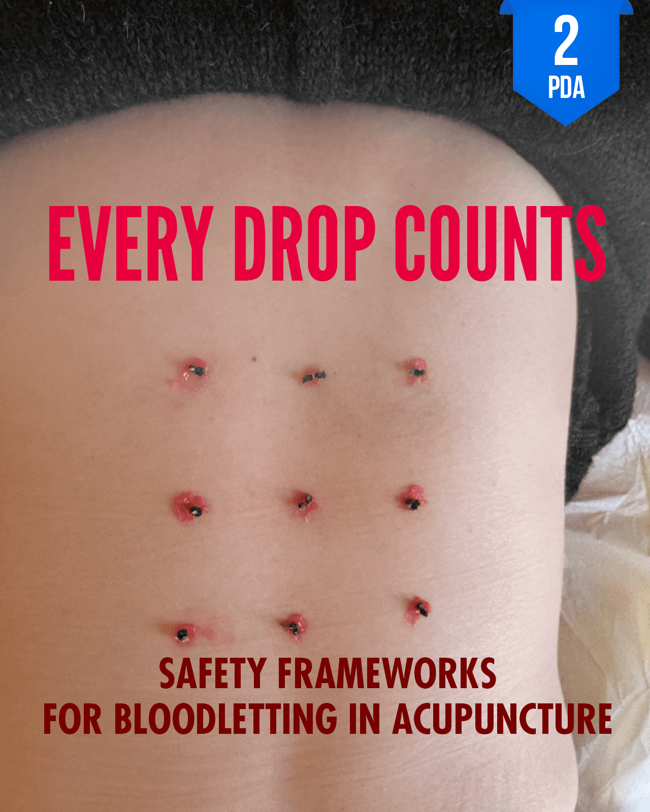 Every Drop Counts: Safety Frameworks for Bloodletting in Acupuncture - NCCAOM Approved Acupuncture Continuing Education, Safety, Medical Errors, 2 PDA/CEU ACEU Masters continuing education florida california nccaom australia uk canada