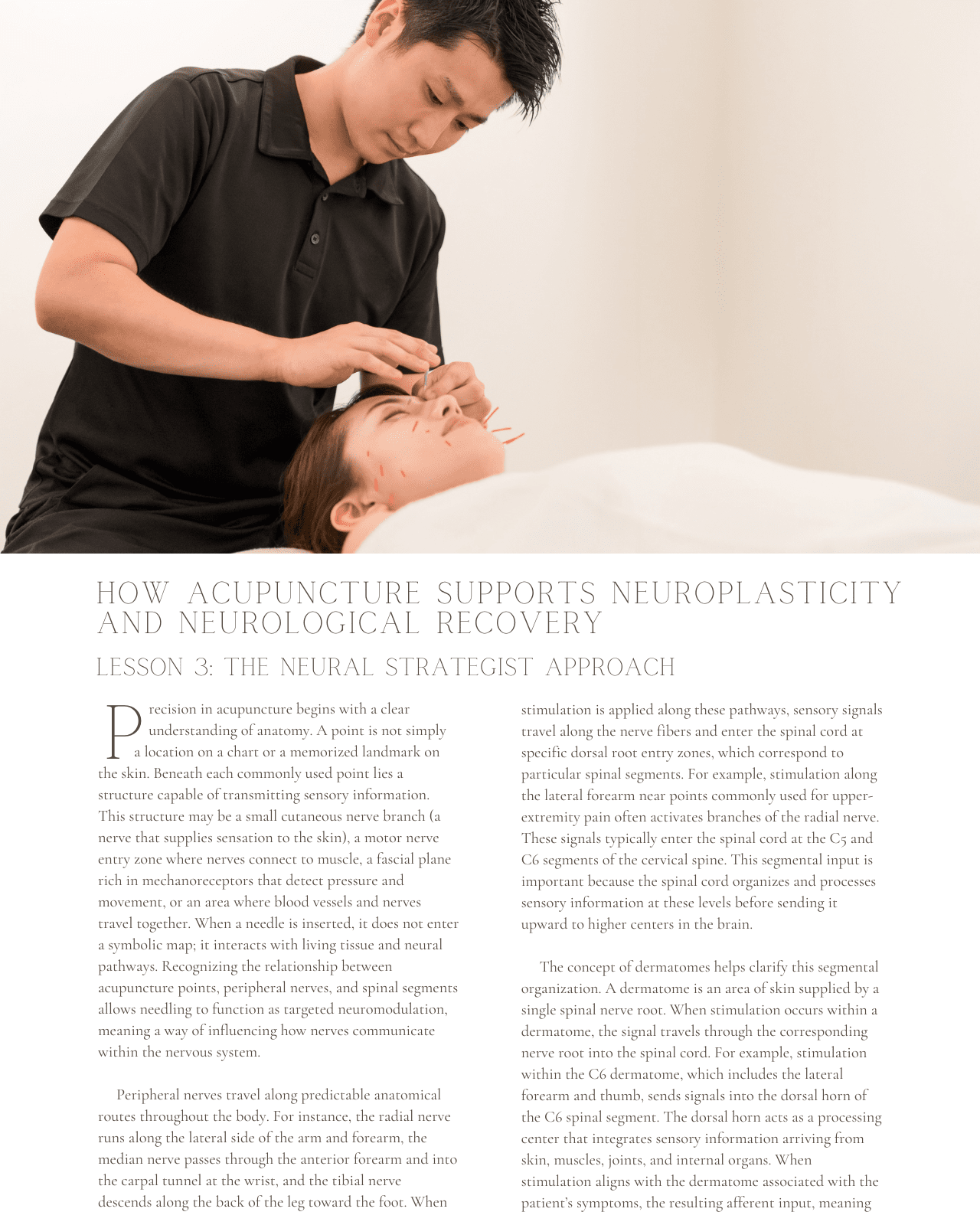 Rewiring the System: How Acupuncture Supports Neuroplasticity and Neurological Recovery - NCCAOM Approved Acupuncture Continuing Education, AOM, Biomedical Sciences, 5 PDA/CEU ACEU Masters continuing education florida california nccaom australia uk canada